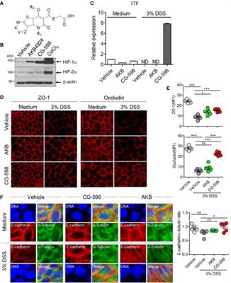 Local Stabilization of Hypoxia-Inducible Factor-1α Controls Intestinal Inflammation via Enhanced Gut Barrier Function and Immune Regulation